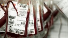 Transfuzija 'mlade krvi' sprečava starenje