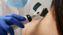 Kreću pozivi na pregled kože zbog melanoma: Evo tko će prvi biti na popisu