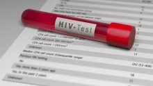 Svjetski dan borbe protiv AIDS-a: U Hrvatskoj niska učestalost infekcije