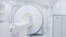 Zaboravite na nelagodu i klaustrofobiju: Magnetna rezonanca od sada s najnaprednijim uređajem