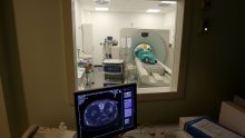 Jeziv broj mladih ljudi dobije jednu od ove 3 vrste raka: Evo kako se zaštititi