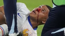 Šok za Francuze; Mbappe slomio nos i trebao je na operaciju. Ali ipak ostaje na Euru!