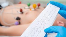 Studija pokazala da rastava roditelja povećava vjerojatnost moždanog udara