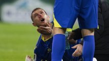 Edin Džeko objavio kako mu izgleda lice nakon brutalnog udarca kopačkom u glavu