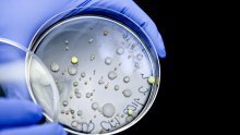 Otkriven antibiotik koji bi mogao djelovati protiv bakterija otpornih na lijekove