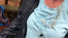 Ženu pogodila munja u prsa. Gorska služba spašavanja objavila fotografiju
