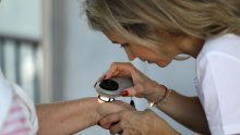 Mnogi su tragično neupućeni o raku kože: Mjesta i simptomi koji će većini ljudi promaknuti