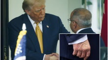 Trumpova ruka otkrila da ima ozbiljnu kroničnu bolest: Ovi simptomi su znak alarma