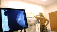 Istraživanje: Rađanje prvog djeteta u starijoj dobi povećava rizik od raka dojke