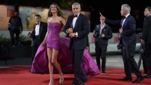 Od gubitka kilograma pa do prometne nesreće: Ove ozljede su Georga Clooneyja skoro došle glave