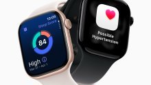 Što donosi sljedeći Apple Watch? Insajderi najavljuju dugo tražen senzor