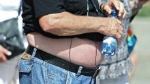WHO će preporučiti popularne lijekove za liječenje pretilosti
