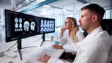 Znanstvenici optimistični: 'Možda imamo lijek za jednu od najtežih neuroloških bolesti'