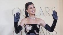 Domaći estetski stručnjak o Anne Hathaway: Što mogu nekirurški tretmani kad se rade pametno