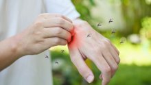 Neugodan virus ruši rekorde po Europi: Pojavio se u državama gdje ga dosad nije bilo
