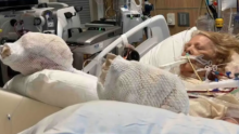 Žena zaspala na bazenu za vrijeme sunčanja: Zatajili joj organi, opečena je do kosti