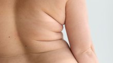 Jedna vrsta masti u tijelu mogla bi imati važnu ulogu i u mentalnom zdravlju