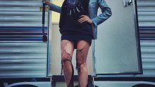 Jadnoj Heidi Klum pukle su mrežaste čarape