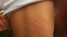 Policija istražuje slučaj 'pendrečenja' zadarskih učenika