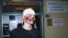 Četvero ranjenih u sukobu desničara s Romima