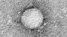 Otkriven lijek koji potpuno liječi hepatitis C!