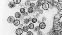 Hantavirus hara Kalifornijom, troje mrtvih