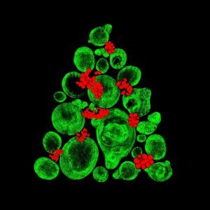 9. Laboratorijski uzgoj tkiva sličnog hrskavici korištenjem matičnih stanica iz kosti (kolagen (zeleno) 20x, masne naslage (crveno) 40x)