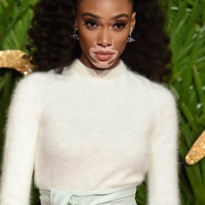 Winnie Harlow