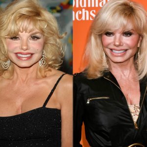 Loni Anderson