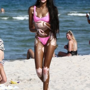 Winnie Harlow