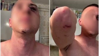 brutalno premlaćivanje