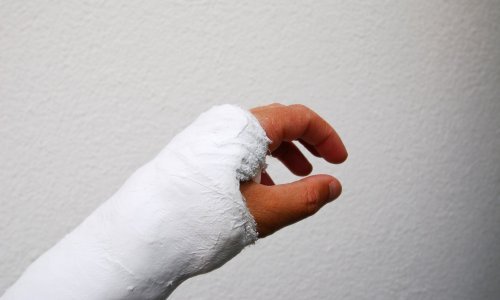 Četrnaestogodišnjoj djevojčici nakon ugriza psa u Splitu slomljena kost