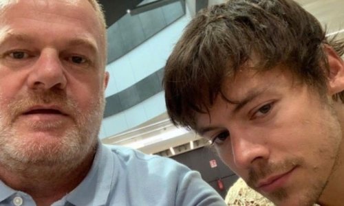 Internet gori: Nova frizura mladog glazbenika izazvala burne reakcije