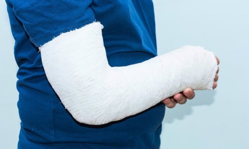 Vojnik u Otočcu napao dječaka letvom i slomio mu ruku, prijeti mu isključenje iz službe