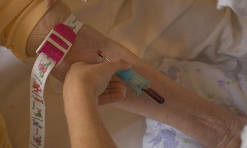 Kujundžić: Nabava analizatora krvi po otocima se otegnula zbog žalbi