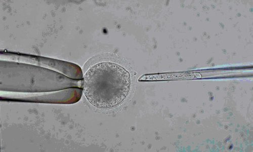 Klonirani embriji odraslih ljudi