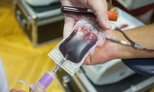 Riječanima nedostaje krvi; darivatelji javite se