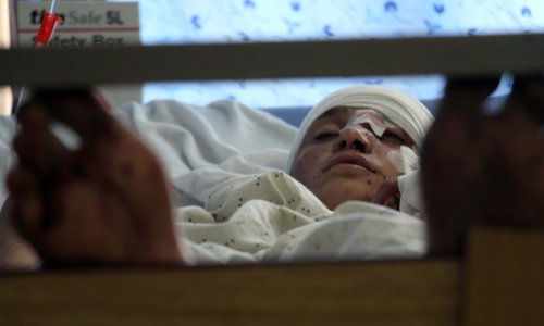 Afganistan: Ove godine dnevno ubijeno ili ranjeno devetero djece