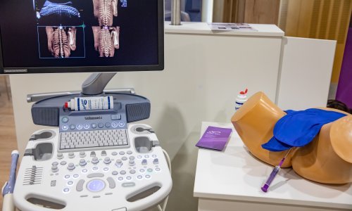 Vinkovačka bolnica dobila tri nova ultrazvučna uređaja