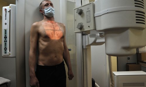 Riječka pulmologinja otkrila kolike su šanse da pasivni pušač oboli od raka pluća
