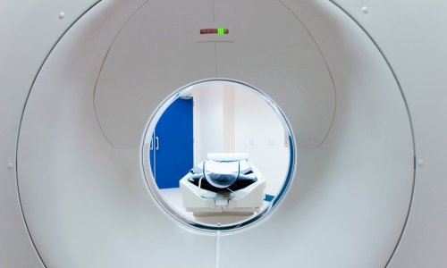 Koordinacija hrvatske obiteljske medicine: Sustav nije spreman za prihvat pacijenata na dijagnostičku obradu za rak pluća