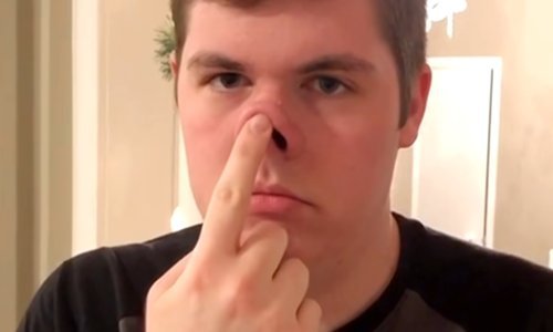 Ovaj momak ima šašavi trik kojim zabavlja društvo