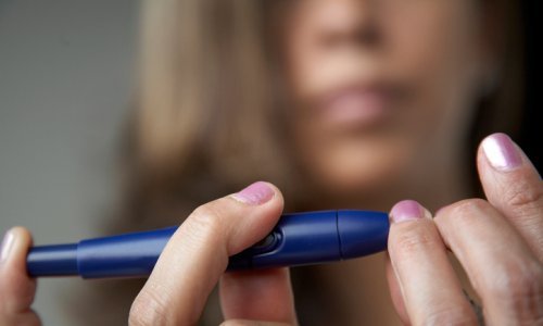 SAD: Više od polovice odraslih ima povišen šećer ili dijabetes