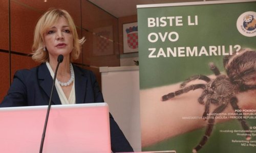 Ne zanemarujte promjene na koži! Sve je više oboljelih od melanoma