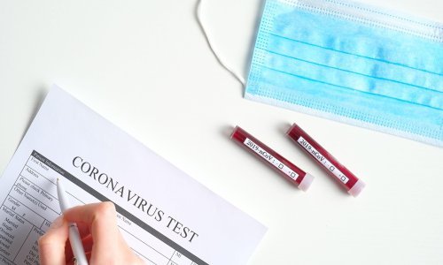 Najvažnija pitanja i odgovori: Što možete učiniti da biste prevenirali zarazu koronavirusom i što napraviti u slučaju da sumnjate na nju