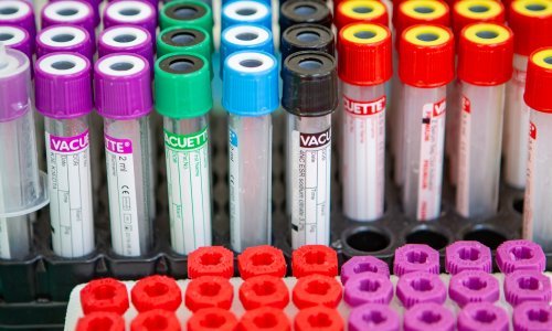 Sedam europskih zemalja kreće s ispitivanjem četiri lijeka za koronavirus na preko tri tisuće pacijenata