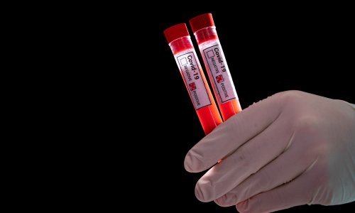 Broj oboljelih od koronavirusa u Hrvatskoj se popeo na 19