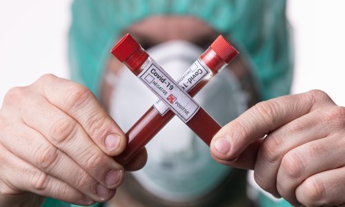 Islamisti prkose koronavirusu: U Pakistanu skup sa 100.000 ljudi