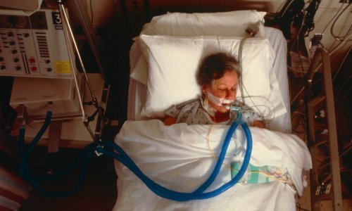 General Electric povećava proizvodnju respiratora zbog koronavirusa