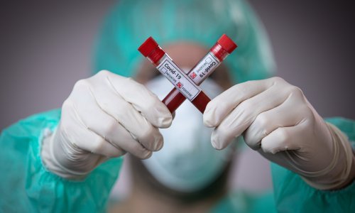 Kola informacija da su se pojavili privatni testovi na koronavirus; provjerili smo je li to zbilja moguće